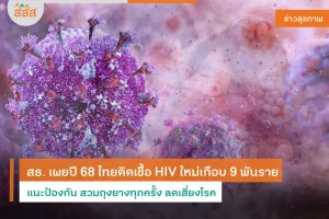 เชื้อ HIV